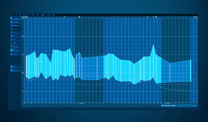 obr. k článku: EKG